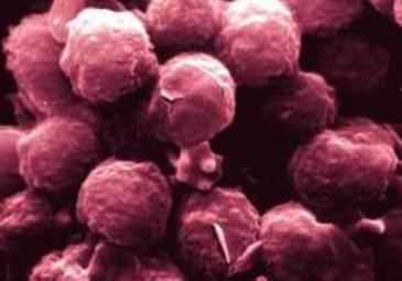 Choroby leczone przy pomocy komórek macierzystych