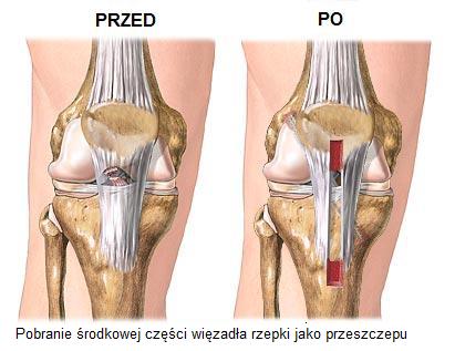 zdjęcie z zabiegu