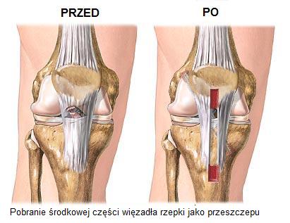 zdjęcie z zabiegu