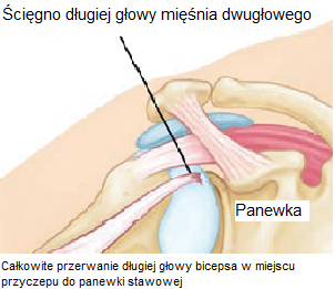 tabletki na mase mięśniową sterydy: Niezwykle łatwa metoda, która działa dla wszystkich